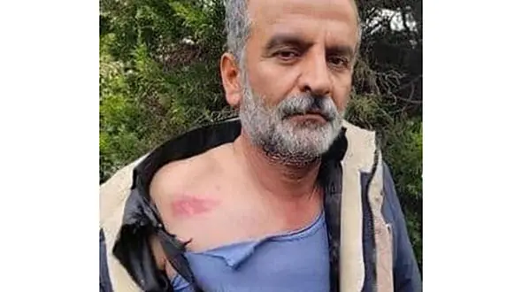 این مرد از شهردار پیربازار رشت کتک خورد + عکس