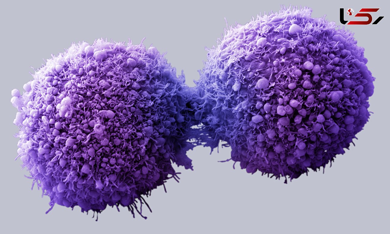 سلول های سرطانی در چخ نوع بافتی رشد می کنند؟