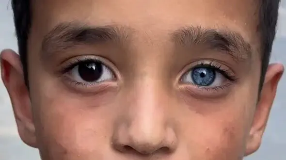 فیلم چشم تا به تا پسر زیبا