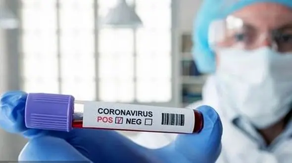 چه علائمی نشان‌دهنده شدت بیماری کرونا هستند؟