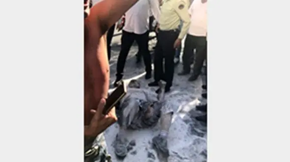 امیدها به بهبودی مردی که خودسوری کرد، افزایش یافت