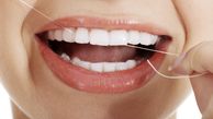 تاثیر نخ دندان در بهداشت دهان