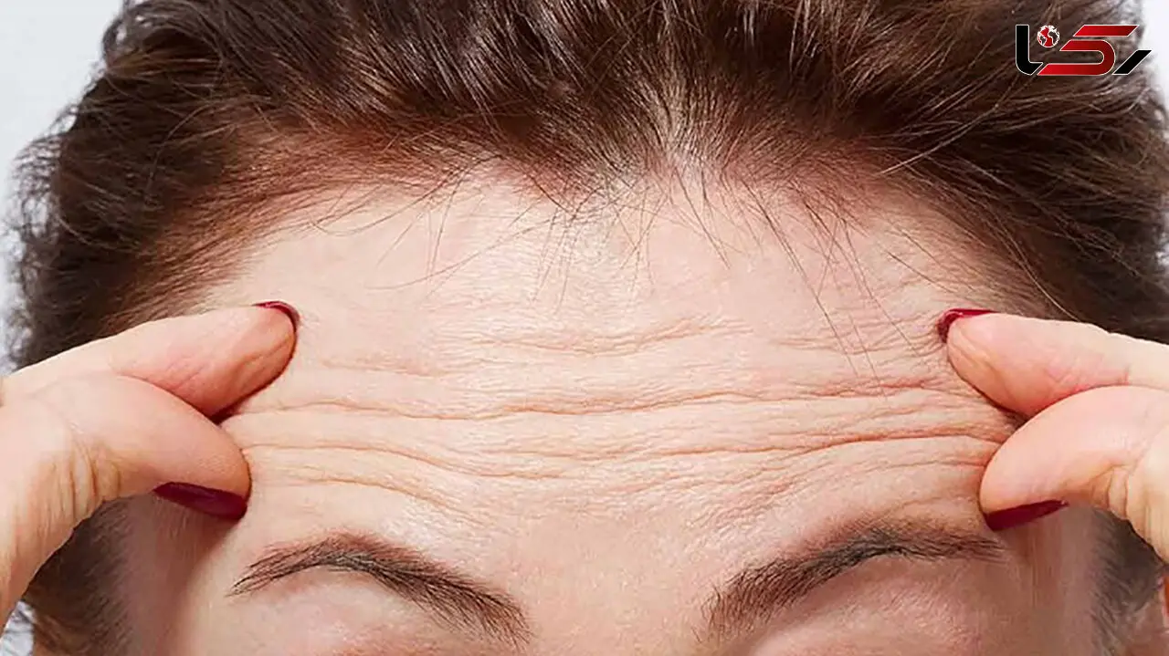 پیشنهادهایی برای جلوگیری از لاغر شدن صورت 