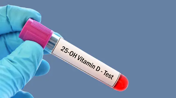 25 oh vit d3 در آزمایش خون چیست؟