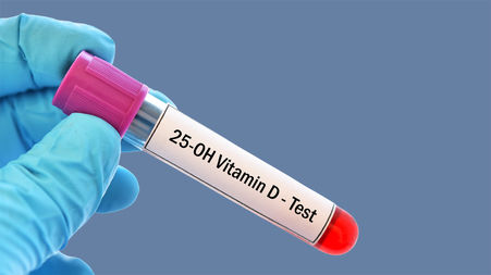 25 oh vit d3 در آزمایش خون چیست؟