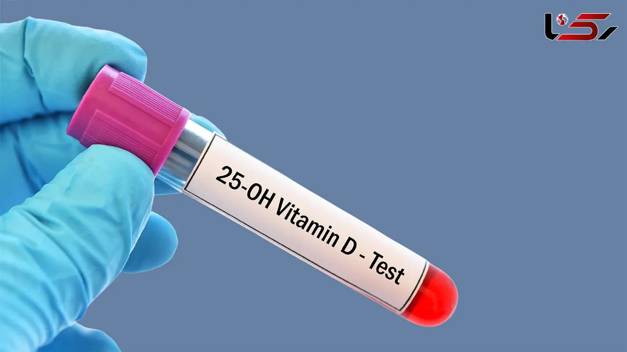 25 oh vit d3 در آزمایش خون چیست؟