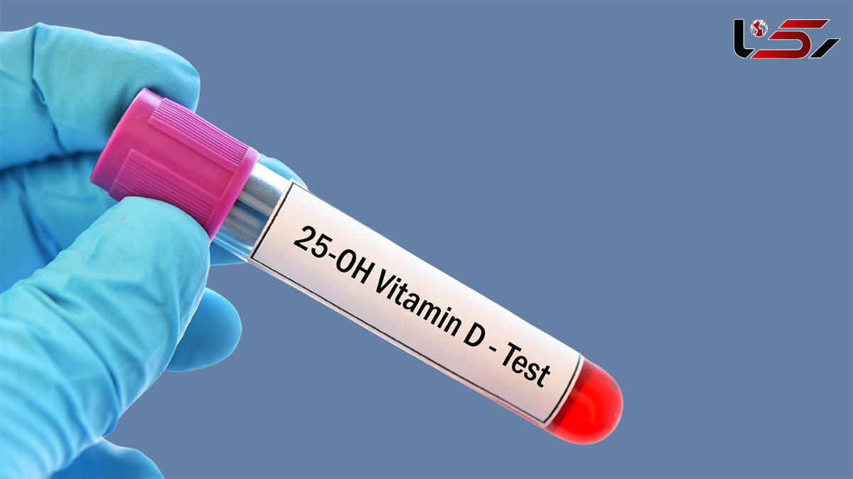 25 oh vit d3 در آزمایش خون چیست؟