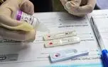 70 درصد مبتلایان به HIV در ایران شناسایی نشده اند/ من تست می دهم  + فیلم