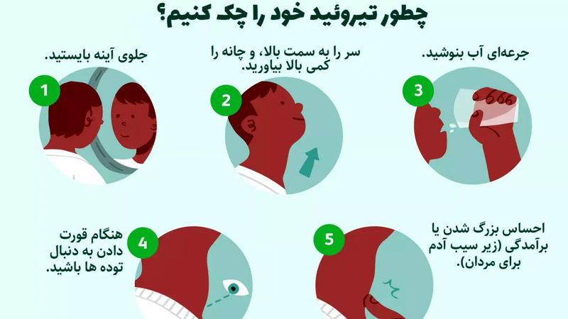 چکاپ تیروئید