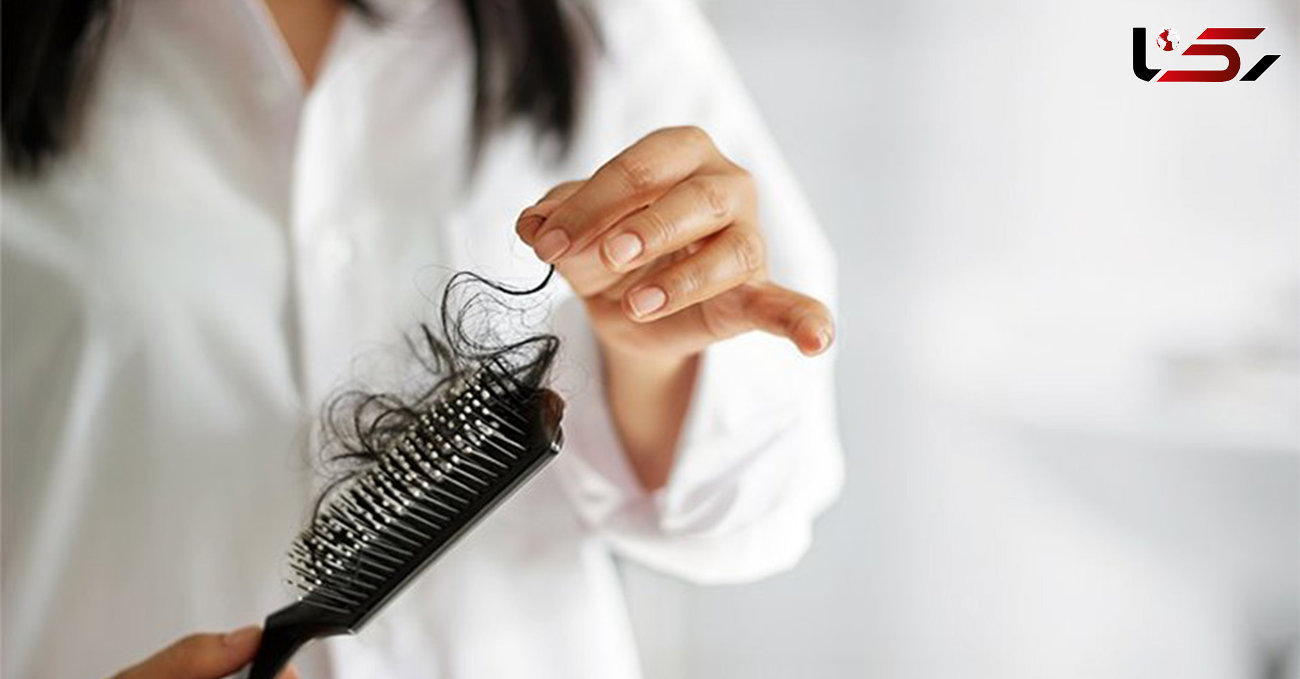 پیشگیری از ریزش مو با مصرف این ویتامین ها