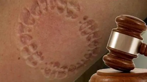 دختری که دست پلیس را گاز گرفت