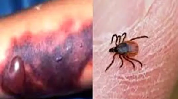 بیماری جدید بلای جان مازندرانی ها