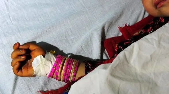 انفجار مین جان ۹ کودک را گرفت