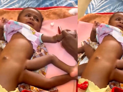 فیلم نوزاد عجیب الخلقه با 8 دست و پا ! / پزشکان جهان شوکه شدند !
