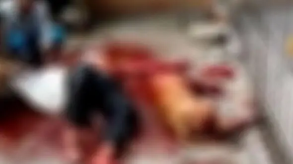 فیلم وحشتناک از حمله سگ به یک انسان / همه جا را خون گرفت 