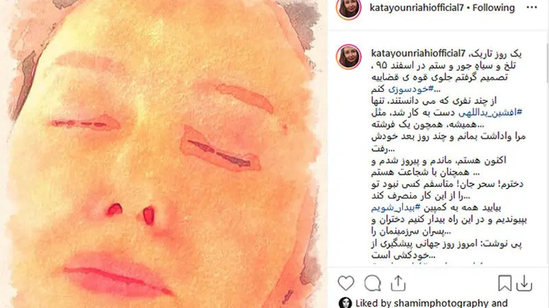 اقدام به خودسوزی بازیگر زن خوش‌چهره سینمای ایران  مقابل قوه قضائیه