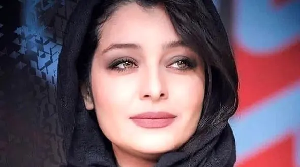 ساره بیات هم لب پروتزی شد / تغییر چهره خانم بازیگر! + عکس