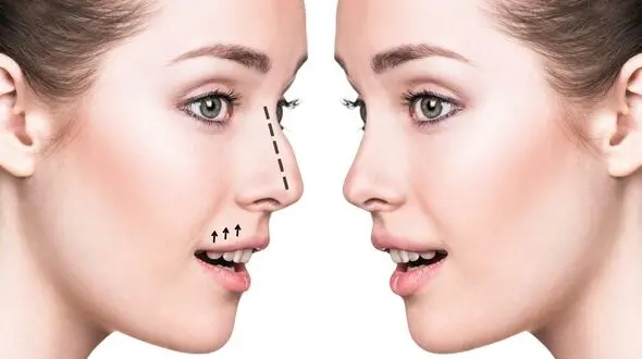 مراحل جراحی بینی از تصمیم گیری قبل از عمل تا روز جراحی
