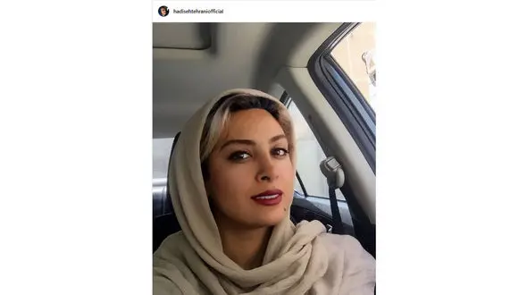 سلفی خانم بازیگر با خال روی صورتش 