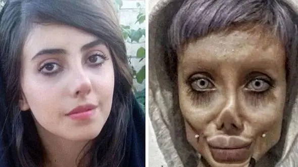 دختر ایرانی بالاخره شبیه آنجلینا جولی شد + عکس