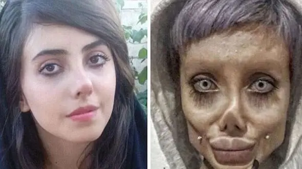 دختر ایرانی بالاخره شبیه آنجلینا جولی شد + عکس