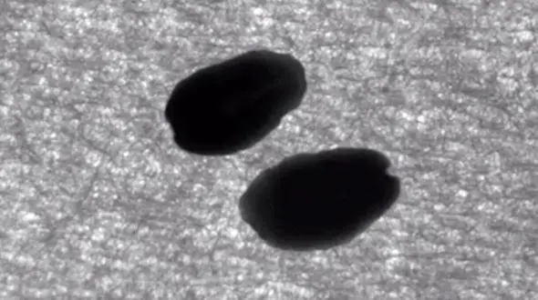 این کرم عضو قطع شده بدنش را بازسازی می کند + فیلم