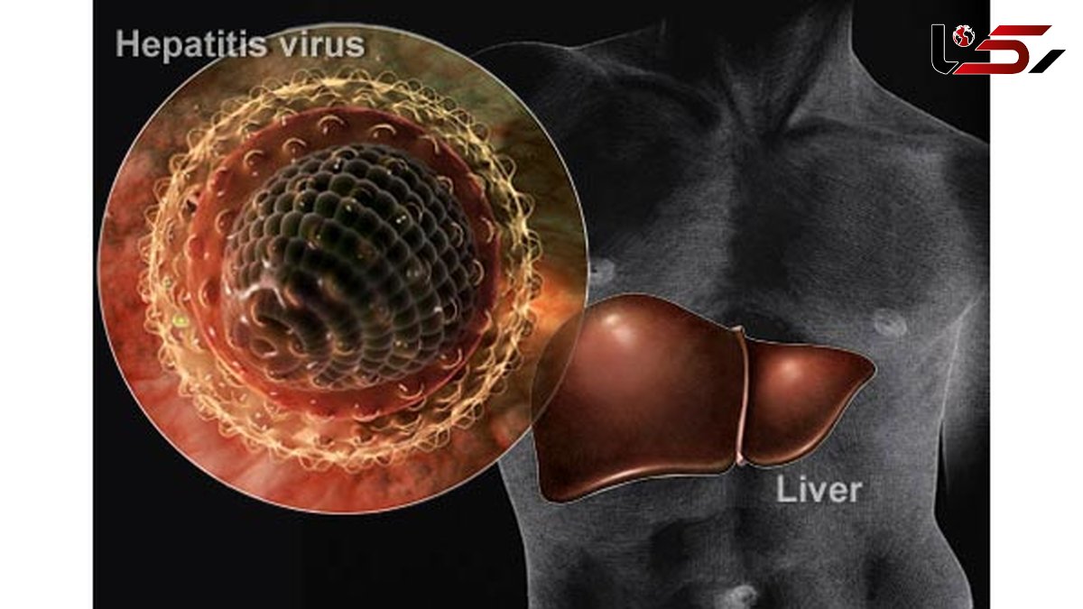 آمار بیماران هپاتیت بى و راه های انتقال و درمان این بیماری 