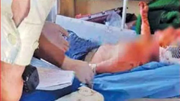 خواستگار سمج گوش های برادر 12 ساله عروس را برید + عکس و جزئیات