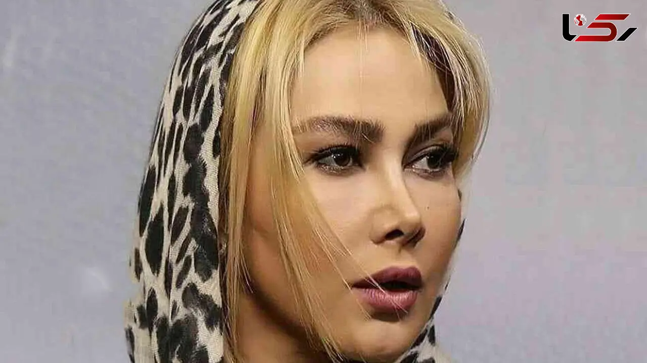 جذابیت آناهیتا نعمتی حتی با چهره ای شکسته ! / تغییر شوک آور خانم بازیگر !