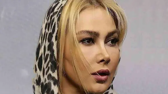 جذابیت آناهیتا نعمتی حتی با چهره ای شکسته ! / تغییر شوک آور خانم بازیگر !