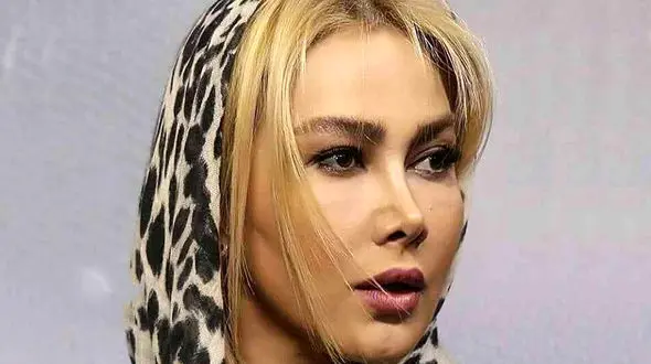 جذابیت آناهیتا نعمتی حتی با چهره ای شکسته ! / تغییر شوک آور خانم بازیگر !