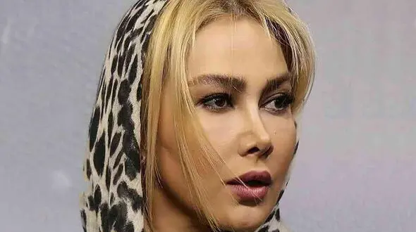 جذابیت آناهیتا نعمتی حتی با چهره ای شکسته ! / تغییر شوک آور خانم بازیگر !