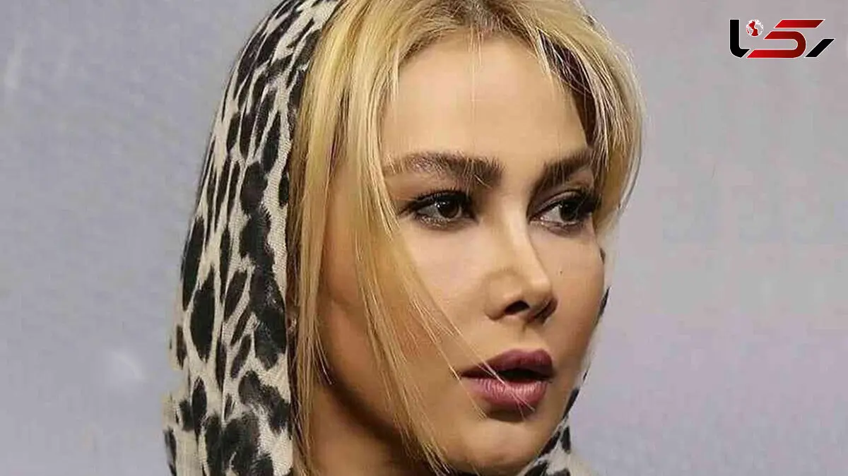 جذابیت آناهیتا نعمتی حتی با چهره ای شکسته ! / تغییر شوک آور خانم بازیگر !