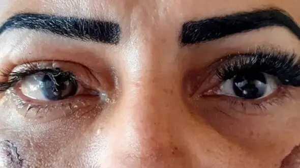  اکستنشن مژه زنی را کور کرد + عکس