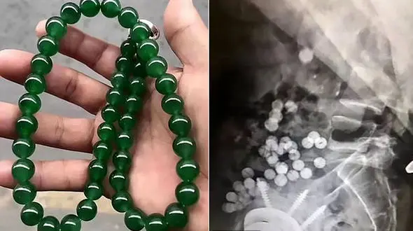 روده این خلافکار ارزش میلیاردی دارد!+عکس