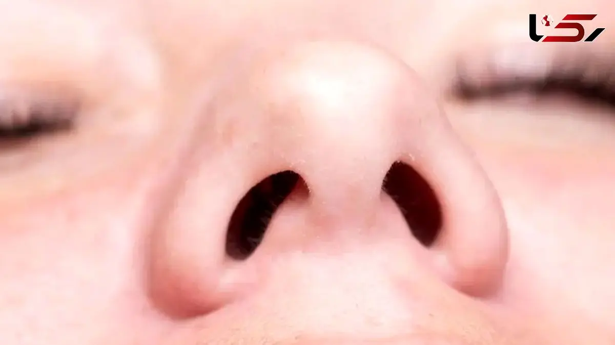 یک سوال عجیب: زندگی با تنها یک سوراخ بینی چگونه است؟