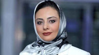 اولین عکس از چهره غیرقابل تحمل یکتا ناصر / خانم بازیگر بدون آرایش با چشم کبود !