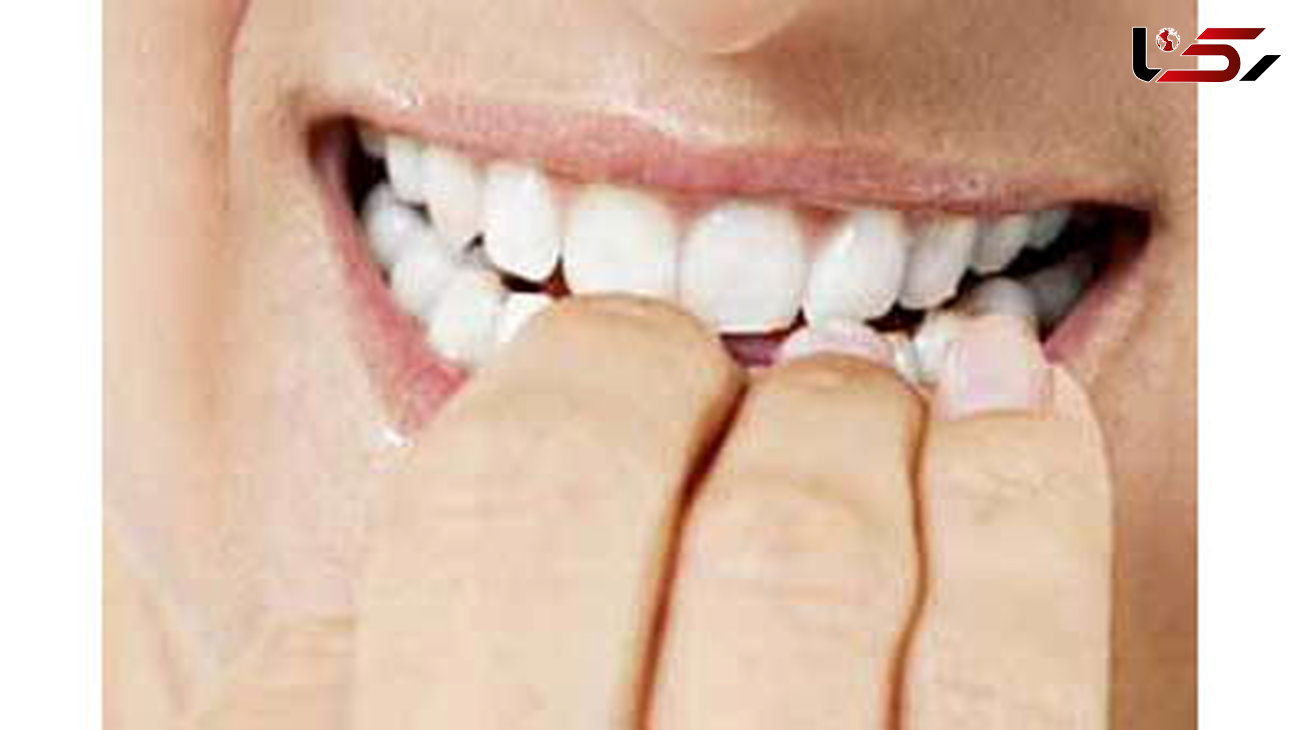آسیب های جبران ناپذیر پودرهای سفید کننده دندان