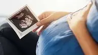 هشدار به مادران باردار / نمک دریایی باعث عوارض مغزی جنین می‌شود