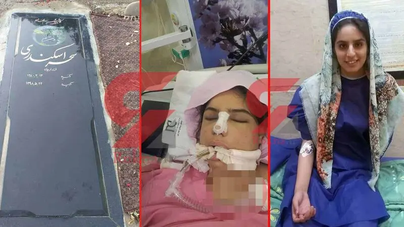 مرگ در اتاق عمل جراحی زیبایی بینی - اهدا عضو