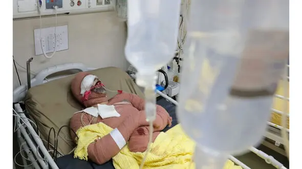 پسرخودسوز زنده ماند / پدر فداکارش کشته شد