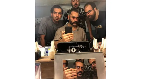 صورت کتک خورده آقای بازیگر +عکس