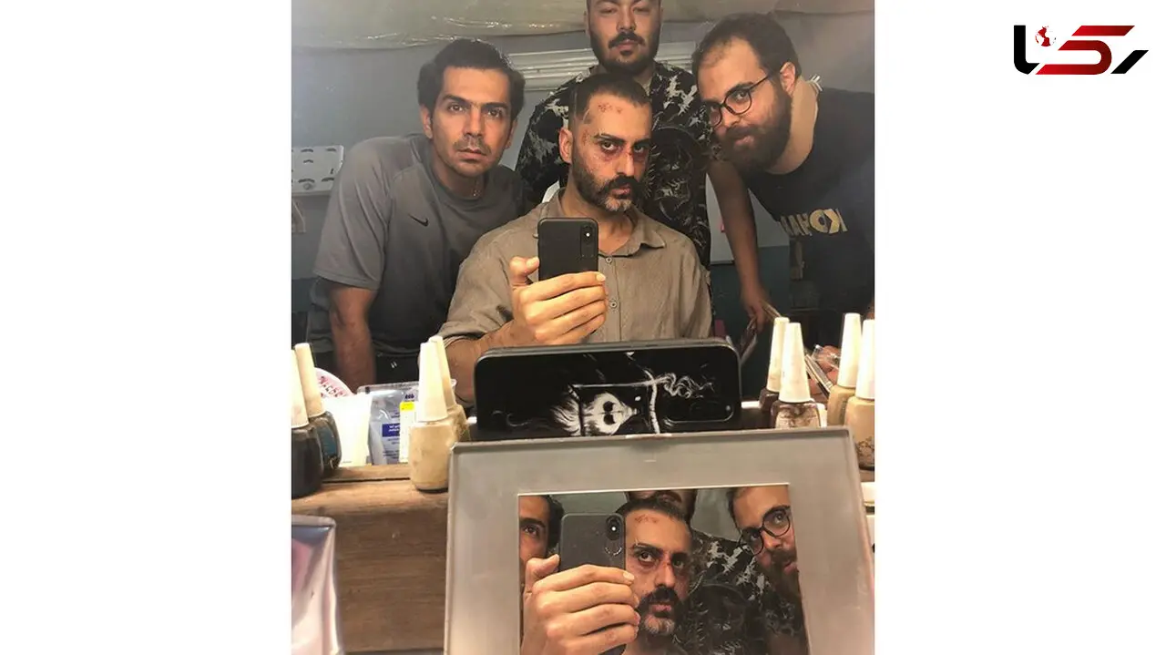 صورت کتک خورده آقای بازیگر +عکس