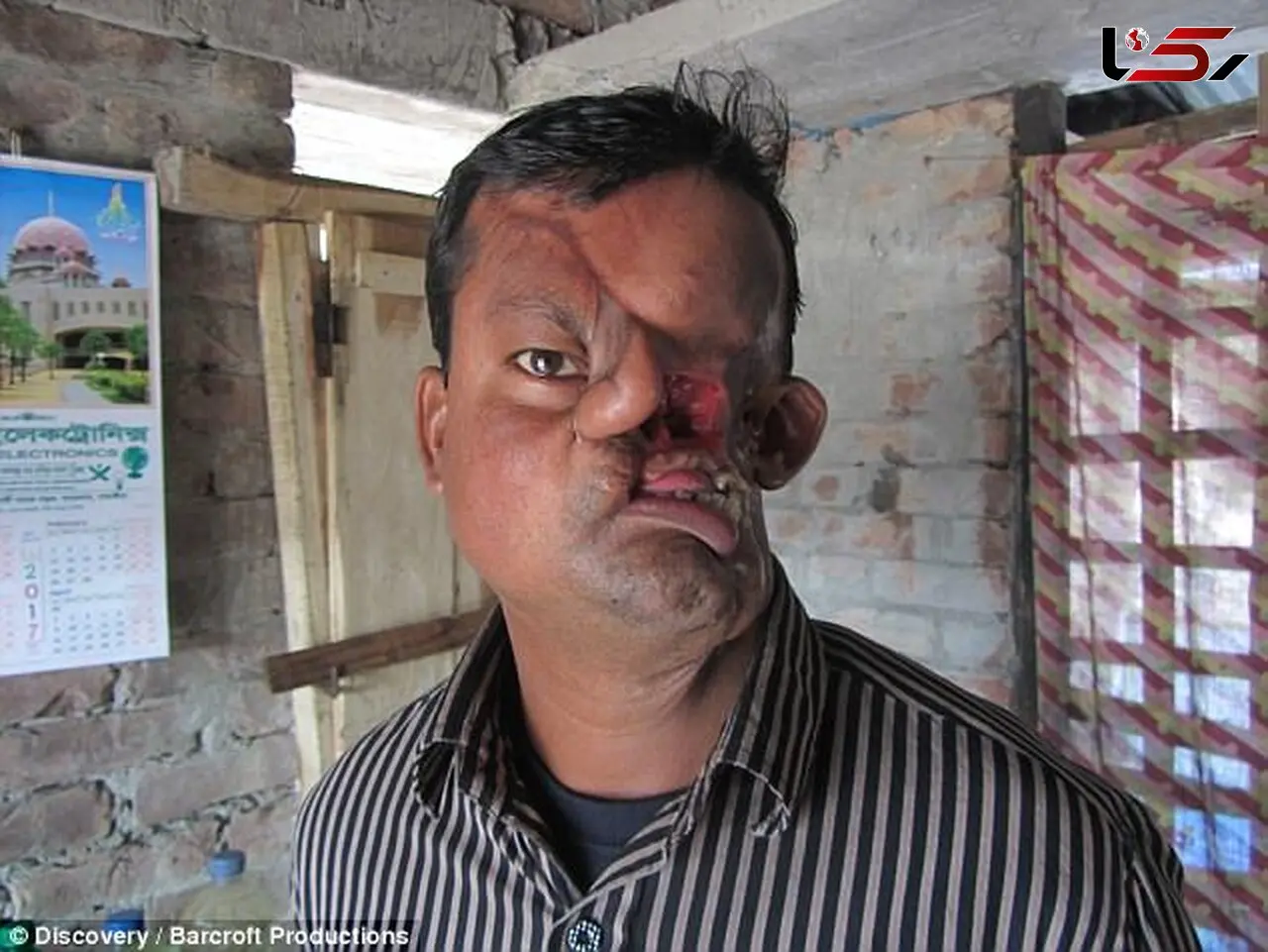 مردی که ببر صورت او را نابود کرده بود به زندگی بازگشت