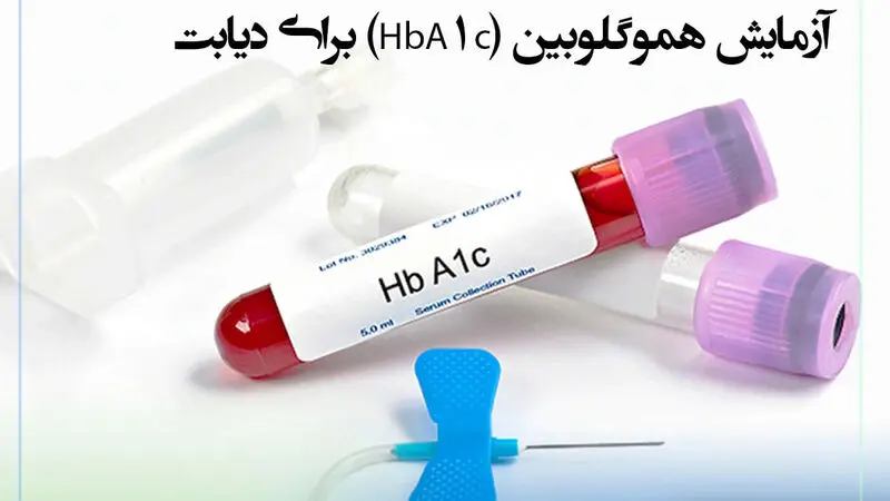 آزمایش هموگلوبین