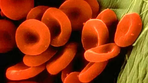 مشکلات فضانوردان در سفرهایی فضایی حل شد/گلبول های قرمزخون در سفر به مریخ کاهش پیدا نمی کند