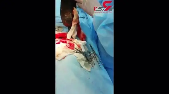 شکم این دختر 12 ساله برآمده بود / همه او را بی عفت دانستند +تصویر