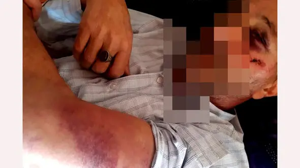 ضرب و شتم 2 جنگلبان در تالش + عکس