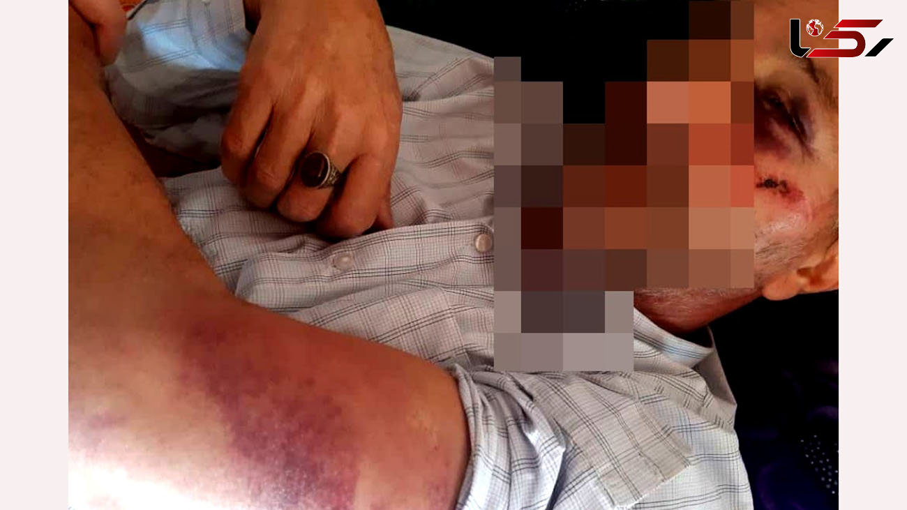 ضرب و شتم 2 جنگلبان در تالش + عکس