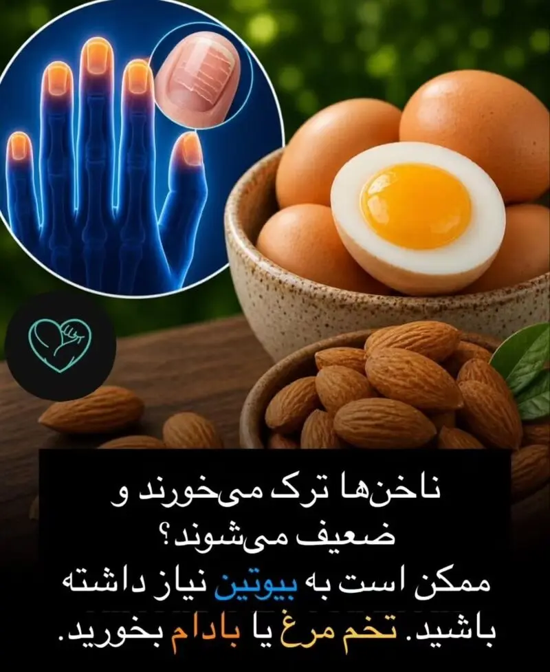 غذای ترک ناخن